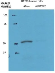 Anti-RUVBL2 antibody, N-term used in Western Blot (WB). GTX77831