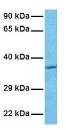 Anti-ASGR2 antibody, N-term used in Western Blot (WB). GTX77833