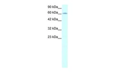 Anti-IVNS1ABP antibody, N-term used in Western Blot (WB). GTX77835