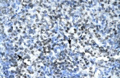 Anti-Claudin 17 antibody, Internal used in IHC (Paraffin sections) (IHC-P). GTX77836