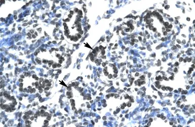 Anti-Claudin 17 antibody, Internal used in IHC (Paraffin sections) (IHC-P). GTX77836