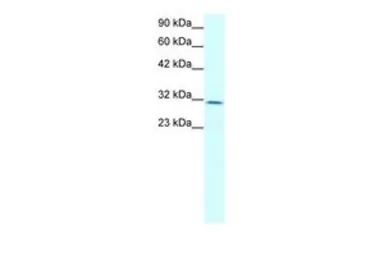 Anti-Claudin 17 antibody, Internal used in Western Blot (WB). GTX77836