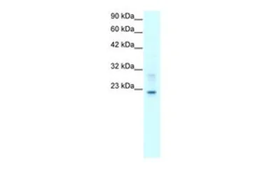 Anti-Claudin 9 antibody, C-term used in Western Blot (WB). GTX77838