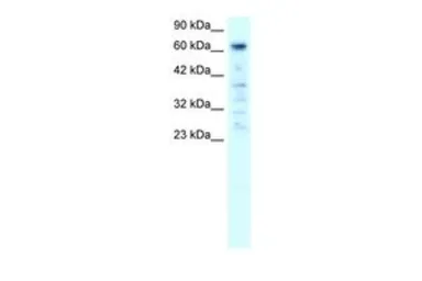 Anti-PARP3 antibody, C-term used in Western Blot (WB). GTX77839