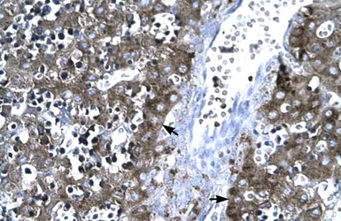 Anti-MMP19 antibody, C-term used in IHC (Paraffin sections) (IHC-P). GTX77841