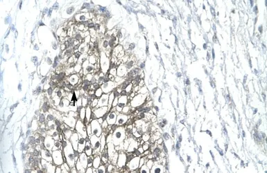Anti-MMP19 antibody, C-term used in IHC (Paraffin sections) (IHC-P). GTX77841