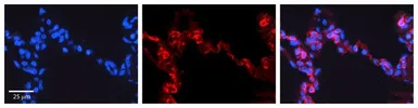 Anti-Prohibitin antibody, C-term used in IHC (Paraffin sections) (IHC-P). GTX77843