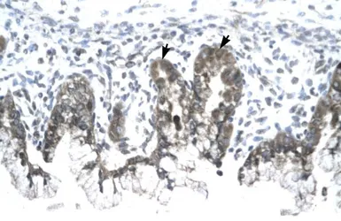 Anti-Prohibitin antibody, C-term used in IHC (Paraffin sections) (IHC-P). GTX77843