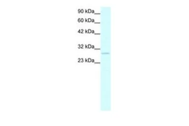 Anti-Prohibitin antibody, C-term used in Western Blot (WB). GTX77843