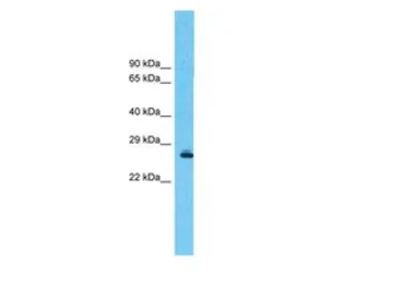 Anti-Prohibitin antibody, C-term used in Western Blot (WB). GTX77843