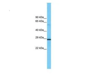 Anti-Prohibitin antibody, C-term used in Western Blot (WB). GTX77843