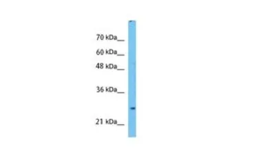 Anti-Prohibitin antibody, C-term used in Western Blot (WB). GTX77843