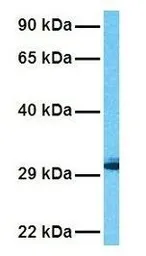 Anti-Prohibitin antibody, C-term used in Western Blot (WB). GTX77843
