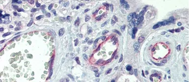 Anti-Claudin 23 antibody, C-term used in IHC (Paraffin sections) (IHC-P). GTX77846
