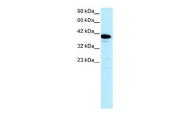 Anti-NFYA antibody, C-term used in Western Blot (WB). GTX77851