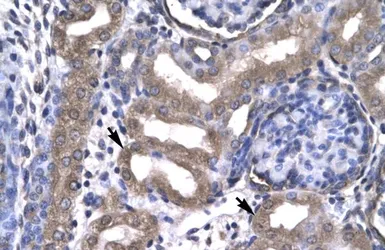 Anti-KIN antibody, Internal used in IHC (Paraffin sections) (IHC-P). GTX77858