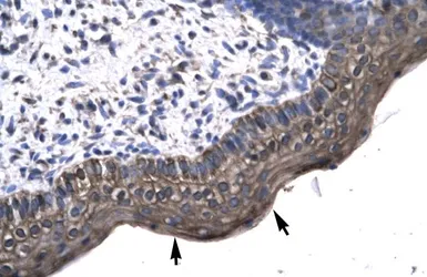 Anti-KIN antibody, Internal used in IHC (Paraffin sections) (IHC-P). GTX77858