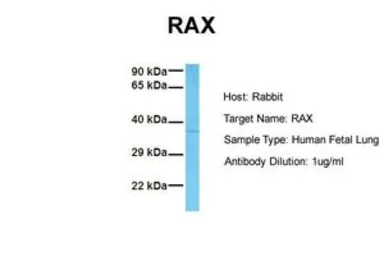 Anti-RAX antibody, N-term used in Western Blot (WB). GTX77859