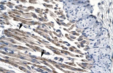 Anti-JMJD8 antibody, Internal used in IHC (Paraffin sections) (IHC-P). GTX77862