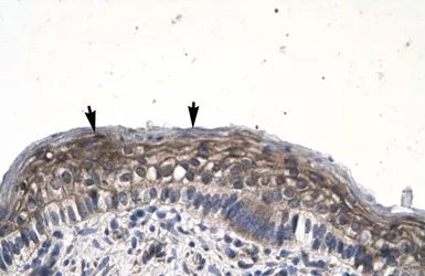 Anti-JMJD8 antibody, Internal used in IHC (Paraffin sections) (IHC-P). GTX77862