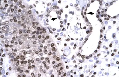 Anti-BARHL2 antibody, Internal used in IHC (Paraffin sections) (IHC-P). GTX77863