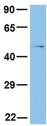 Anti-PAX4 antibody, Internal used in Western Blot (WB). GTX77866