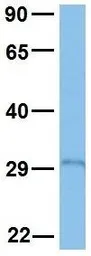 Anti-PAX4 antibody, Internal used in Western Blot (WB). GTX77866