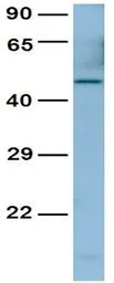 Anti-PAX4 antibody, Internal used in Western Blot (WB). GTX77866