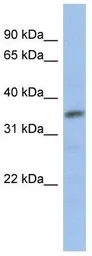 Anti-MYF5 antibody, N-term used in Western Blot (WB). GTX77867