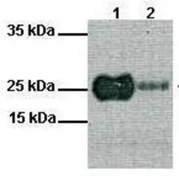Anti-MYF5 antibody, N-term used in Western Blot (WB). GTX77867
