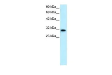 Anti-DBP antibody, N-term used in Western Blot (WB). GTX77870