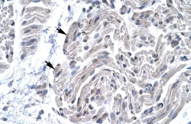 Anti-FOXE3 antibody, C-term used in IHC (Paraffin sections) (IHC-P). GTX77875