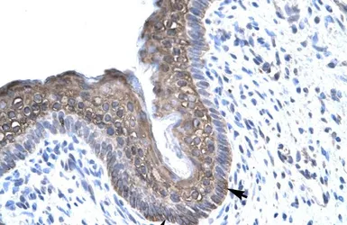 Anti-FOXE3 antibody, C-term used in IHC (Paraffin sections) (IHC-P). GTX77875