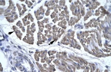 Anti-EYA3 antibody, Internal used in IHC (Paraffin sections) (IHC-P). GTX77877