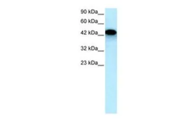 Anti-EYA3 antibody, Internal used in Western Blot (WB). GTX77877