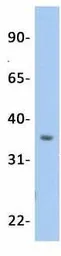 Anti-OTX2 antibody, N-term used in Western Blot (WB). GTX77880