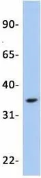 Anti-OTX2 antibody, N-term used in Western Blot (WB). GTX77880