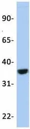 Anti-OTX2 antibody, N-term used in Western Blot (WB). GTX77880
