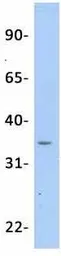 Anti-OTX2 antibody, N-term used in Western Blot (WB). GTX77880
