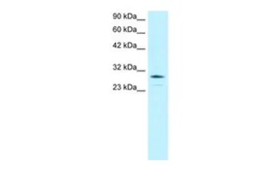 Anti-OTX2 antibody, N-term used in Western Blot (WB). GTX77880