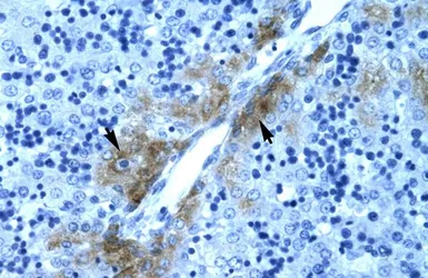 Anti-GATA3 antibody, C-term used in IHC (Paraffin sections) (IHC-P). GTX77882