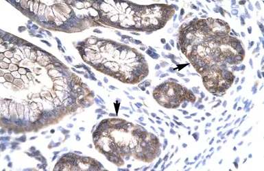 Anti-MOX1 antibody, N-term used in IHC (Paraffin sections) (IHC-P). GTX77885