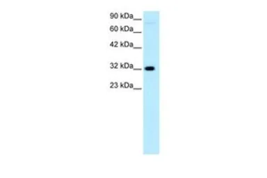 Anti-MOX1 antibody, N-term used in Western Blot (WB). GTX77885