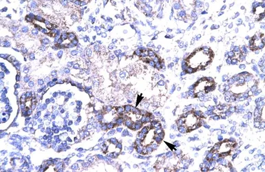 Anti-PAR4 antibody, Internal used in IHC (Paraffin sections) (IHC-P). GTX77887