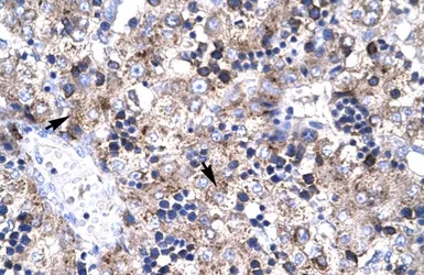 Anti-PAR4 antibody, Internal used in IHC (Paraffin sections) (IHC-P). GTX77887