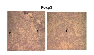 Anti-FOXP3 antibody, N-term used in IHC (Frozen sections) (IHC-Fr). GTX77889