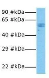 Anti-FOXP3 antibody, N-term used in Western Blot (WB). GTX77889