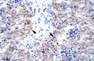Anti-TIP30 antibody, N-term used in IHC (Paraffin sections) (IHC-P). GTX77890