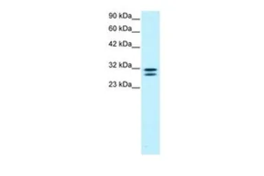 Anti-TIP30 antibody, N-term used in Western Blot (WB). GTX77890