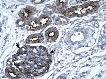 Anti-GABPA antibody, C-term used in IHC (Paraffin sections) (IHC-P). GTX77894